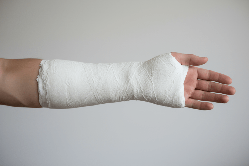 Heal Your Broken Forearm Fast (Rehab Tips That Work)